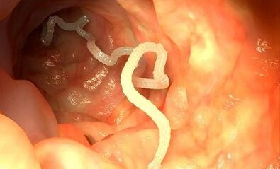 Causas de los parásitos en el cuerpo humano.