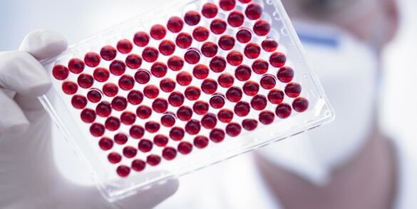 análisis de sangre para gusanos