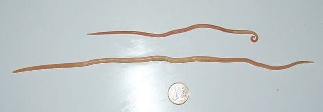 Gusano Ascaris del cuerpo humano.