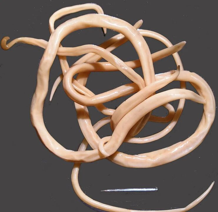 lombrices intestinales en el cuerpo humano